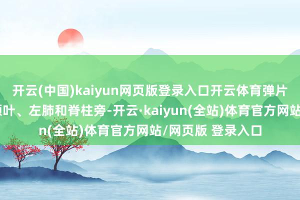 开云(中国)kaiyun网页版登录入口开云体育弹片深深镶嵌她的右额叶、左肺和脊柱旁-开云·kaiyun(全站)体育官方网站/网页版 登录入口